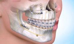 Область медицины, объединяющая стоматологию и хирургию