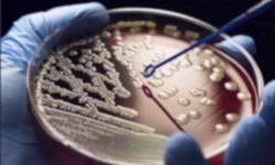 Тест подсказывает подходящий антибиотик