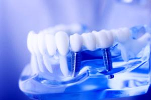 актуальные вопросы хирургической стоматологии